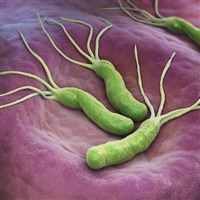 Helicobacter pylori e le ulcere